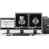 Acies Mammo Viewer License
