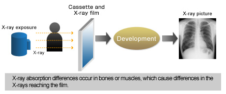 Fig. 1 X-Ray Photography (Analog)
