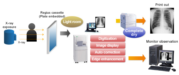 Fig. 2 X-Ray Photography (Digital)