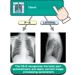 Automatic Body Part Recognition.