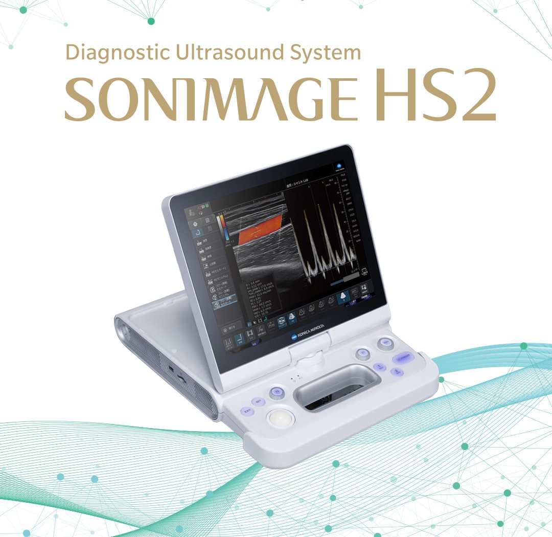 Diagnostic Ultrasound System SONIMAGE HS2