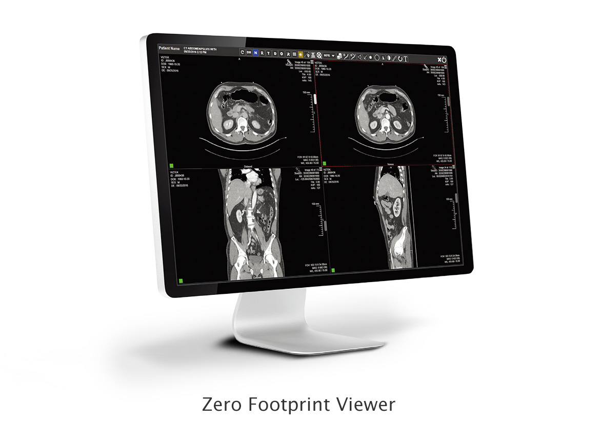 Zero Footprint Viewer