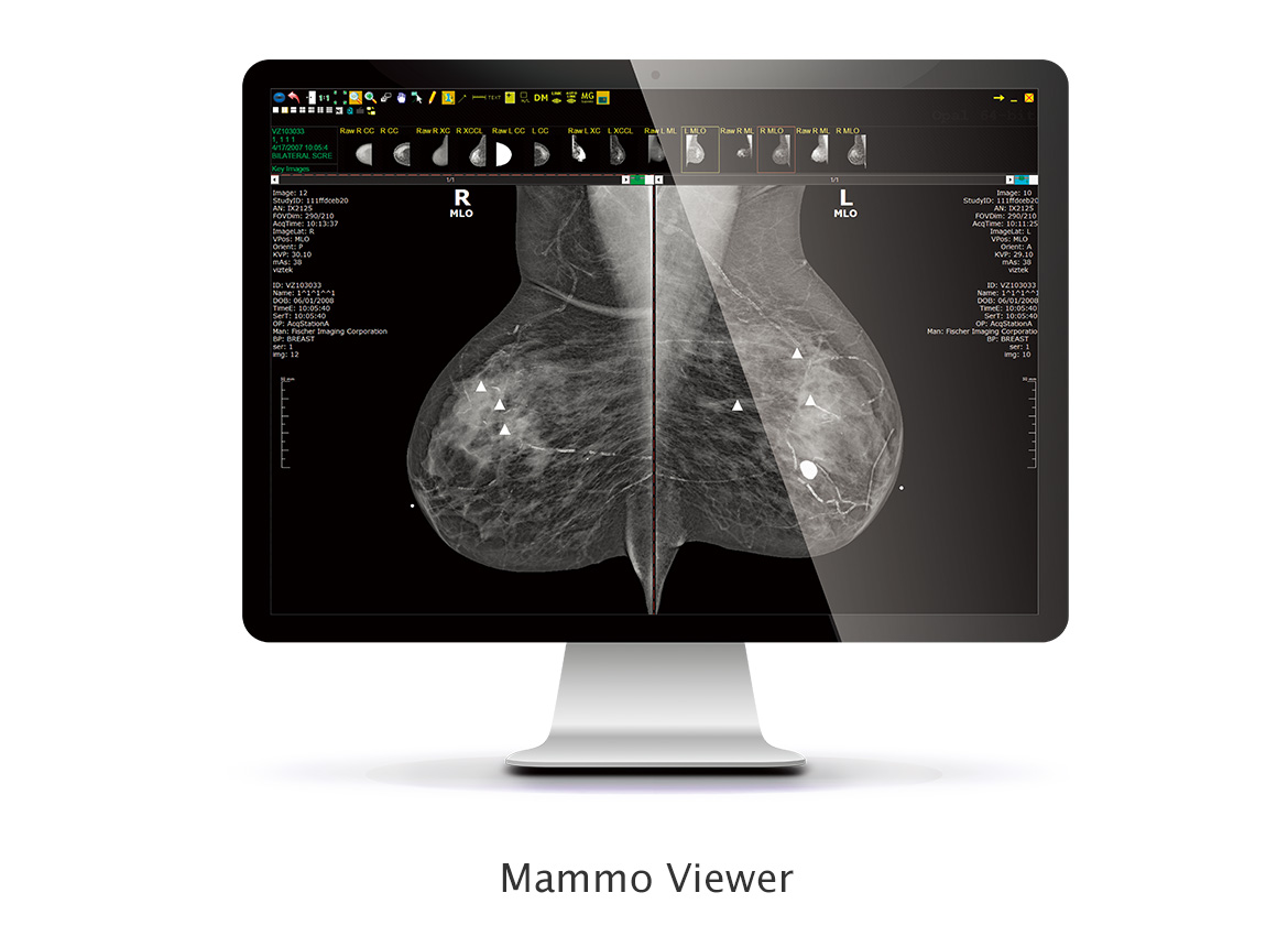Mammo Viewer