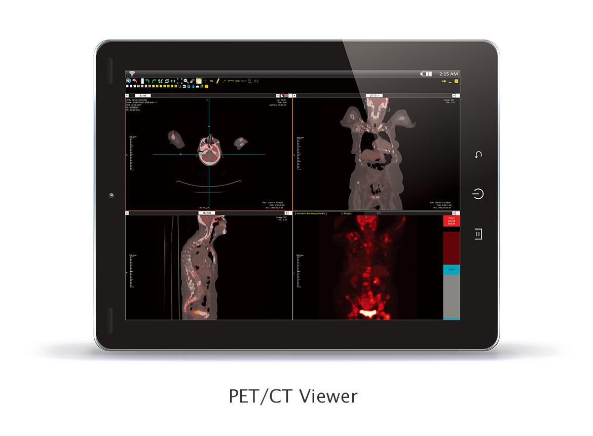 PET/CT Viewer