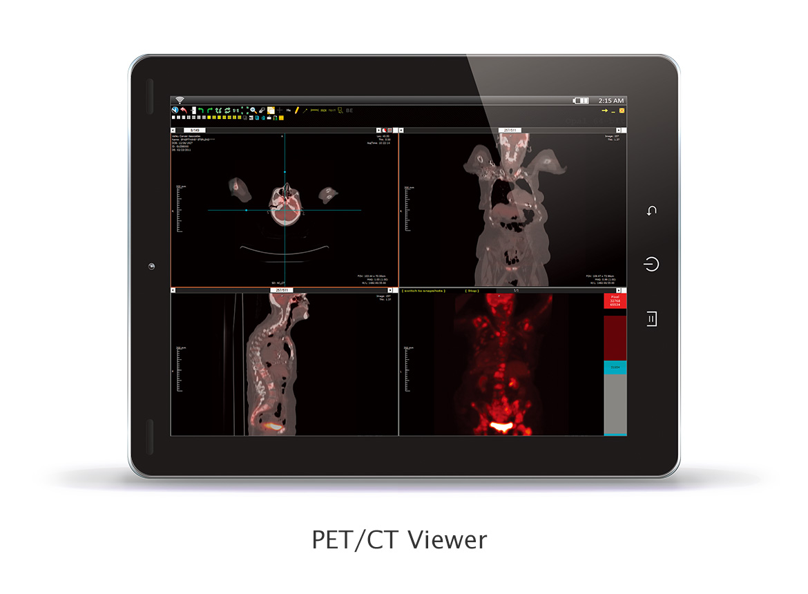 PET CT Viewer