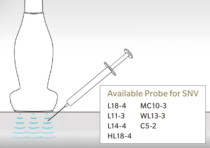 Available probe for SNV