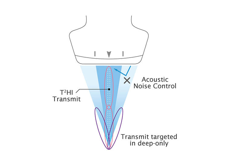 Imaging Performance