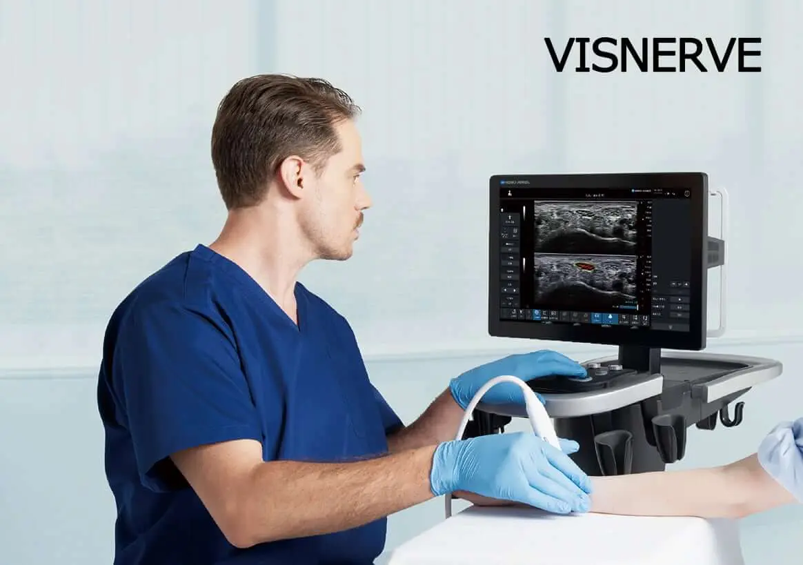 SONIMAGE UX1 VISNERVE