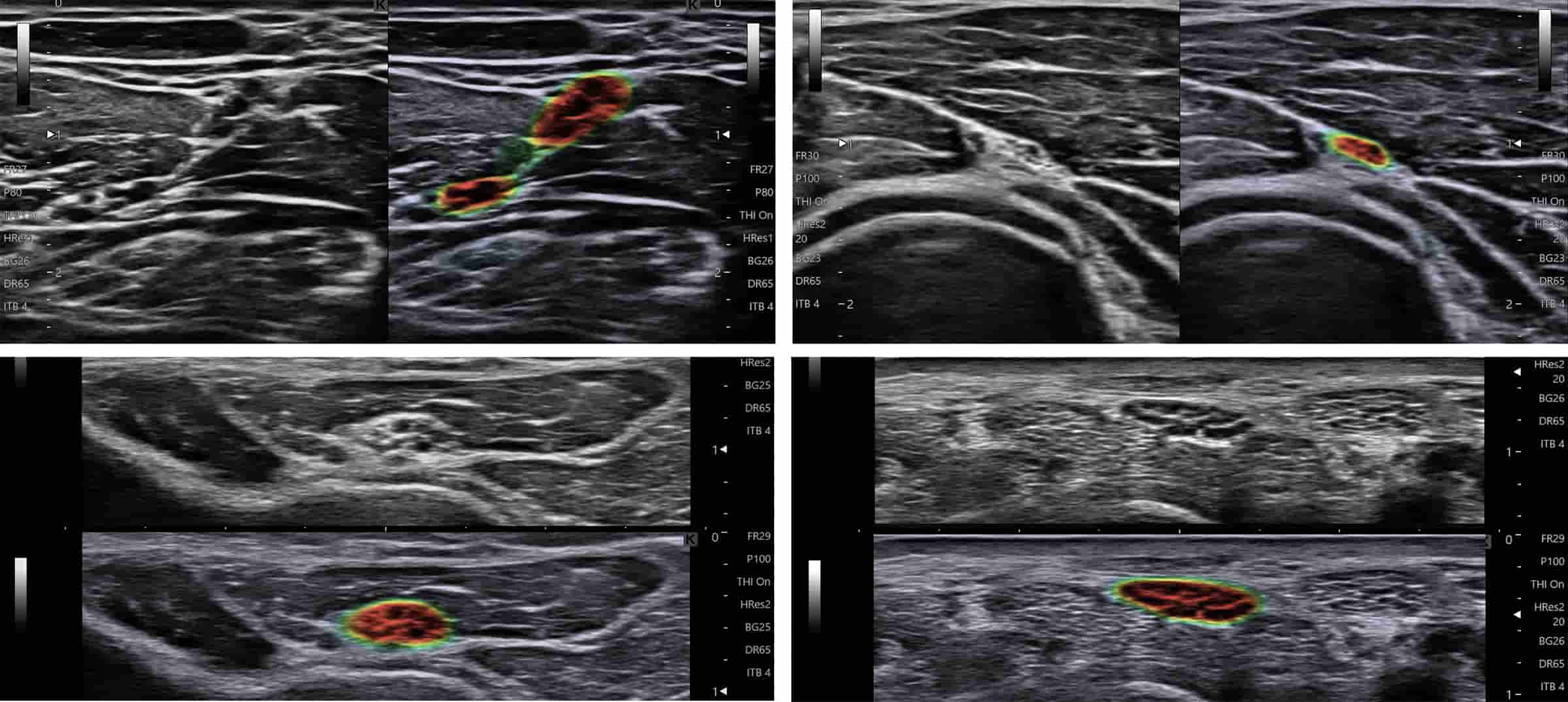VISNERVE