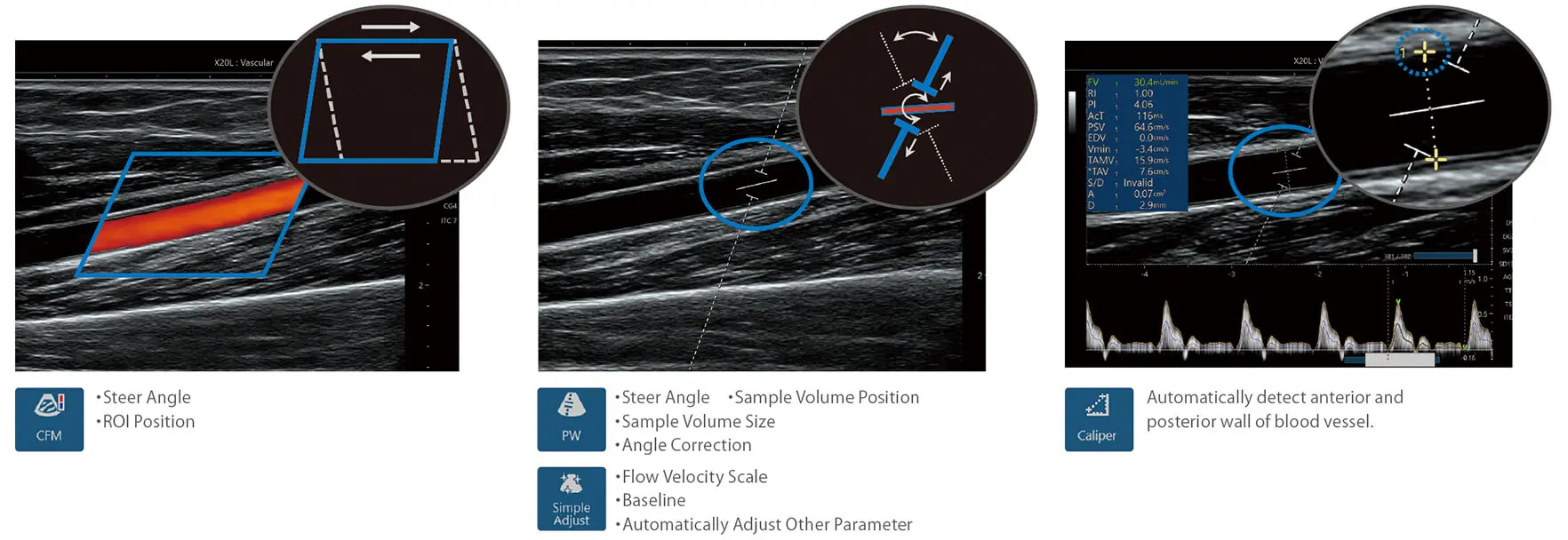 Vascular NAVI