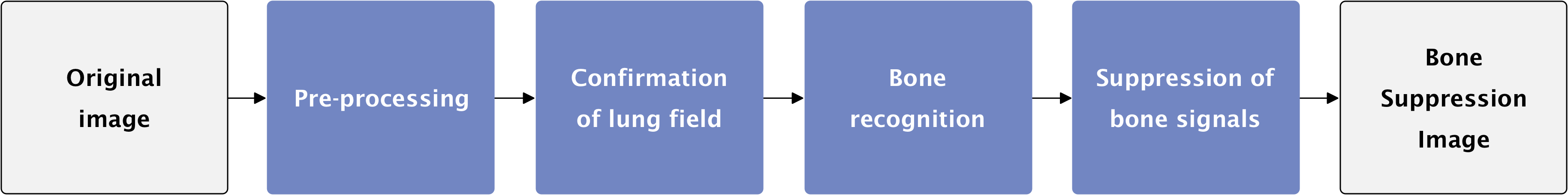 Bone Suppression Image processing technology algorithms