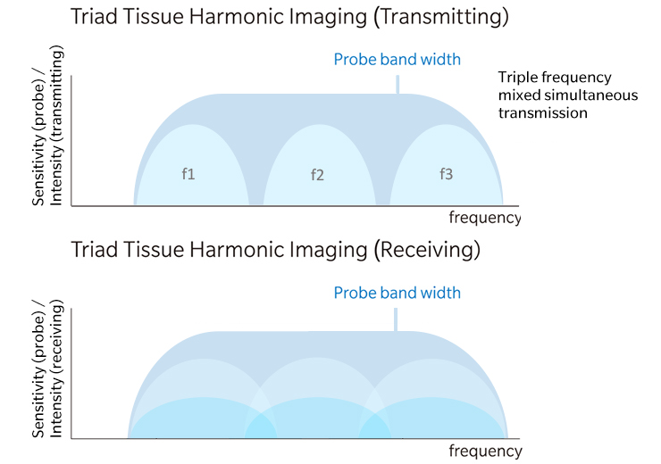 T2HI Triad Tissue Harmonic Imaging