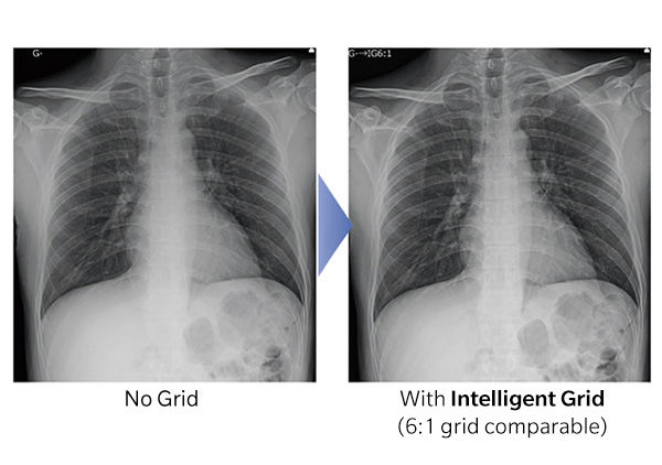 Intelligent Grid