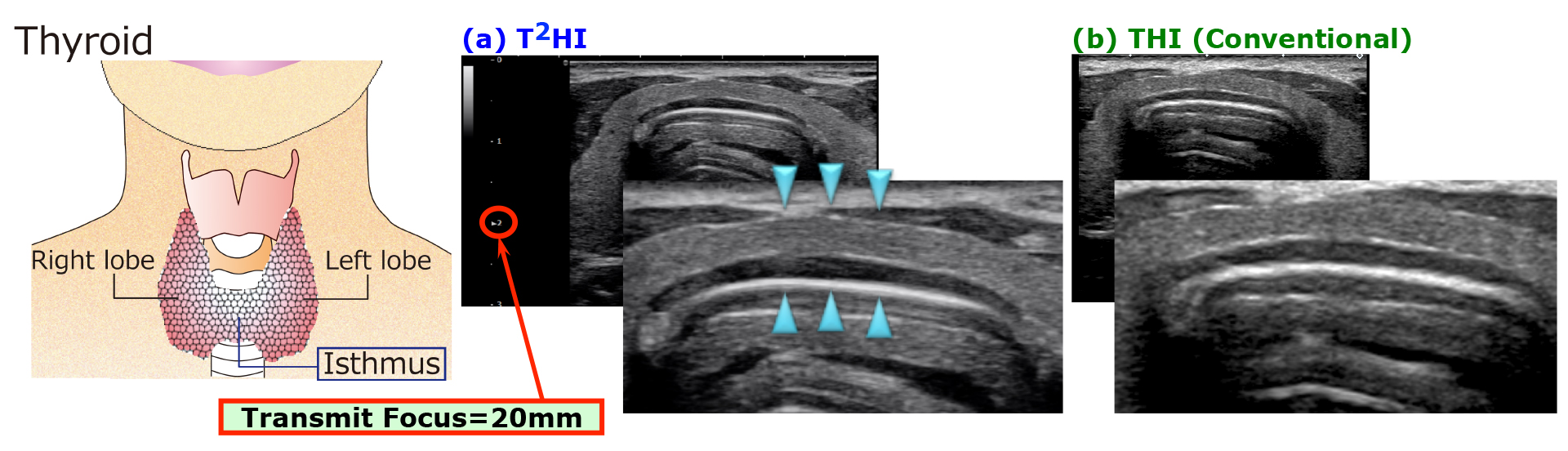 Development of a new technology, T2HI