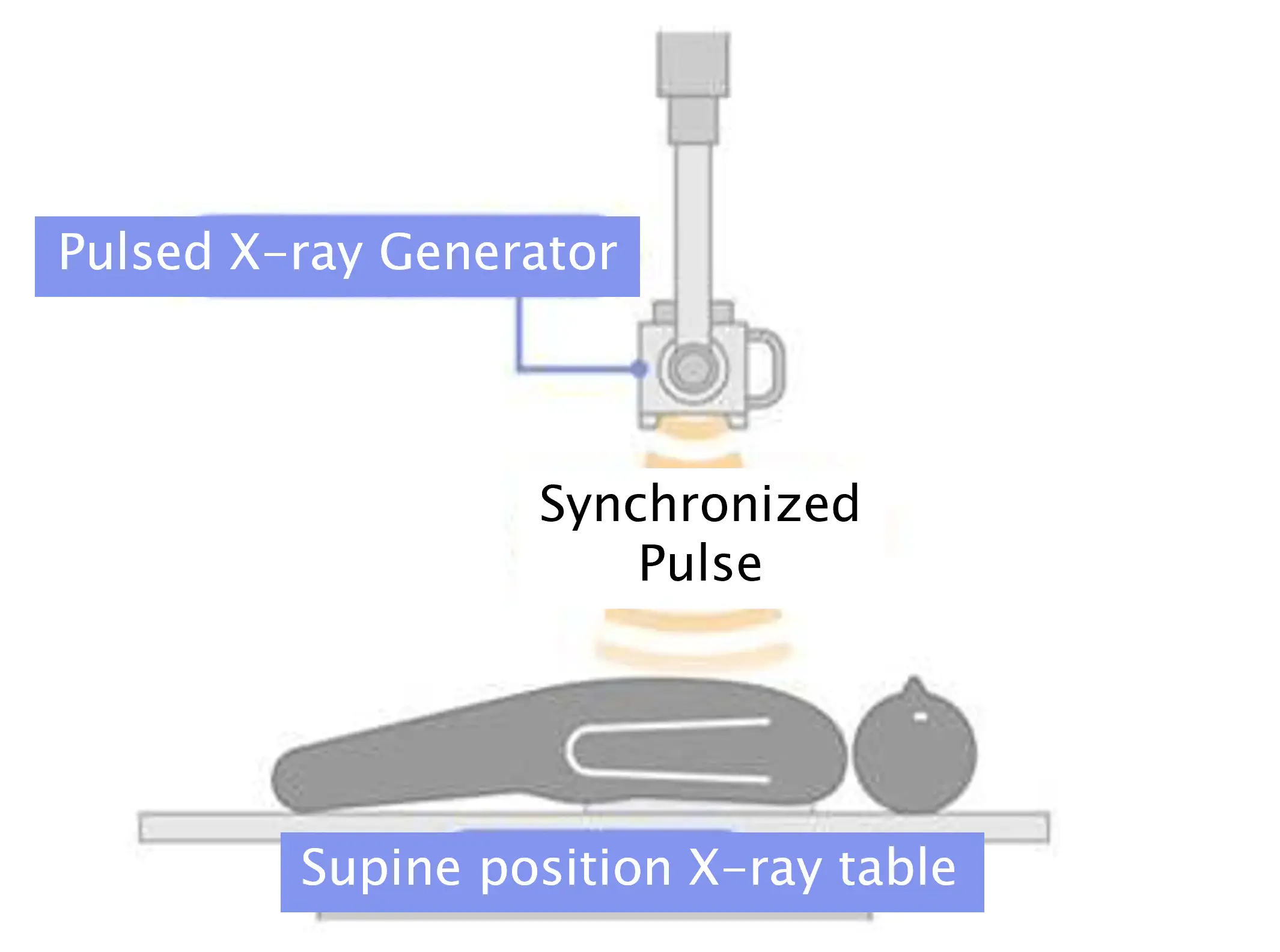 Image of pulmonary perfusion imaging using Dynamic Digital Radiography