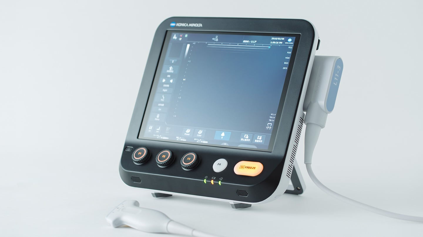 「超音波診断装置 SONIMAGE MX1」の写真です。