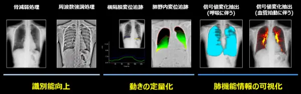 X線動態
