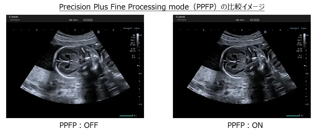 Precision Plus Fine Processing mode(PPFP)の比較イメージ
