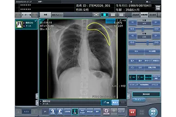 画像診断ワークステーション「CS-7」の新機能としてSTAT画像所見報告支援機能「STAT Link」の提供を開始
