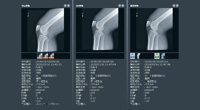 技術的な-フルカラーＣＧで学ぶＸ線撮•影のポジショ•ニングと