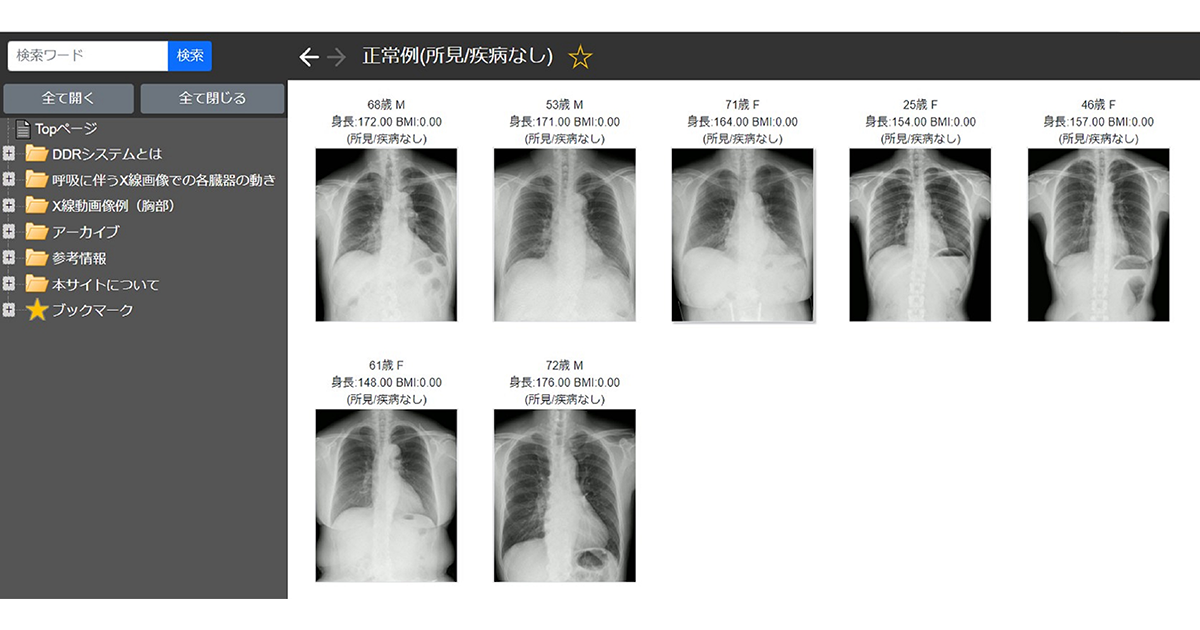 Radiology Review Manual 放射線レビュー ラジオロジー